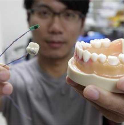 Измислиха умен зъб, който ще помага да се храним здравословно
