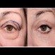 Как да изтриете торбичките и сенките само за 10 минути! Откакто ползвам тази смес кожата ми се опъна и фон дьо тена е в боклука! 