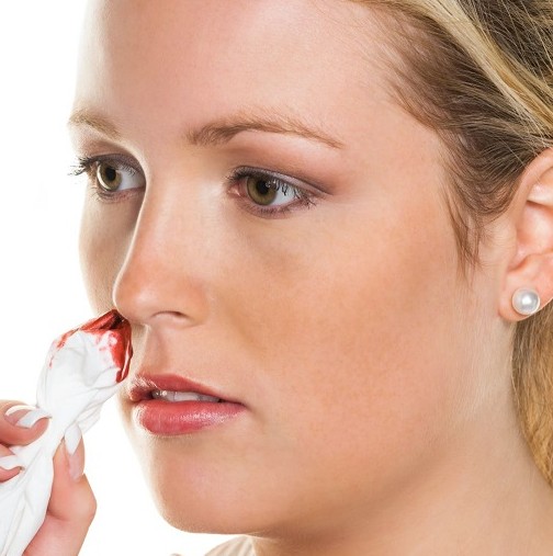 Правилно спиране на кръвотечение от носа-Много от нас го правят погрешно-Основни стъпки