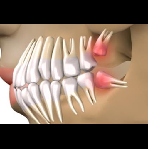 За девет седмици може да ви пораснат нови зъби с тази иновативна технология!