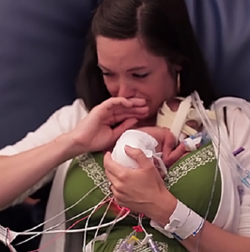 Това недоносено бебе, разтопи сърцата на целия свят! Няма друга такава история (видео)