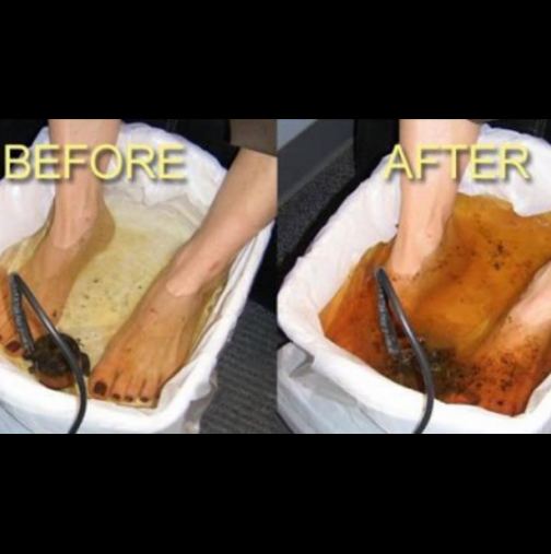 Изхвърлете всички токсини от вашето тяло: Домашна детоксикация чрез баня на краката! 