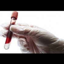Показатели при кръвен тест, които след 30-годишна възрст трябва да знаем