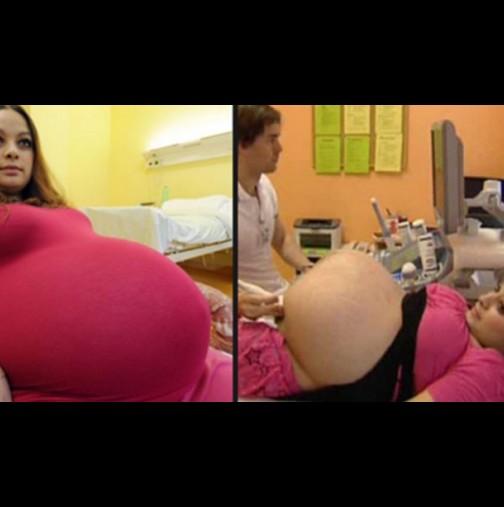 Помисли си, че е бременна с близнаци, но лекарят на ултразвука разкрива нещо, което ги накара да извикат