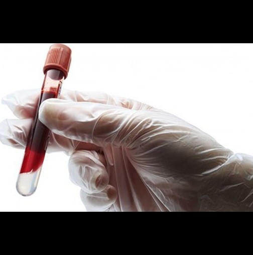 Показатели при кръвен тест, които след 30-годишна възрст трябва да знаем