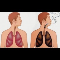 Тези 6 храни ще изчистят никотина от тялото ви и ще възстановят дробовете ви- активен или пасивен пушач, всеки има нужда от тях