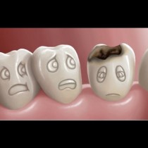 Зъболекари съветват: Ето как да спрете гниенето на зъбите с тези прости нещица, спазвайте ги и няма да се виждаме често