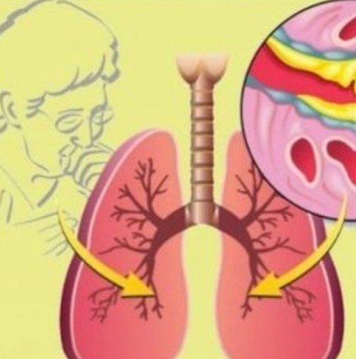 Еликсирът на баба винаги спасява положението, когато хапчетата не действат- облекчава болките в гърлото и чисти кашлицата