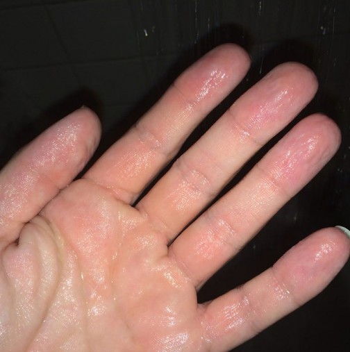Само трябва да потопите пръстите си в студена вода за 30 секунди ще разберете, дали сте здрави 