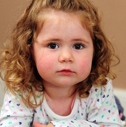Двегодишно детенце малтретирано в детска градина