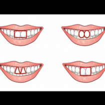 Предните зъби разкриват характера -Проверете на приятелите си, дали има съвпадение