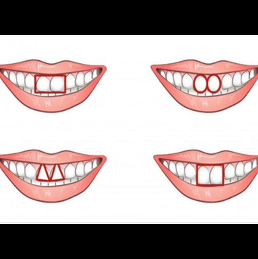 Предните зъби разкриват характера -Проверете на приятелите си, дали има съвпадение