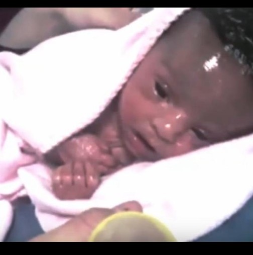 Поради кожата й, майка й я нарече сирена: Ето защо това бебе е много специално