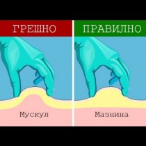 Ако недай си Боже ви се наложи да сложите инжекция по спешност, ето как да го направите (снимки)