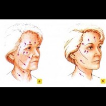 Този метод ми помогна бързо да изгладя лицето си и да се отърва от бръчките! Сега го правя всяка вечер!