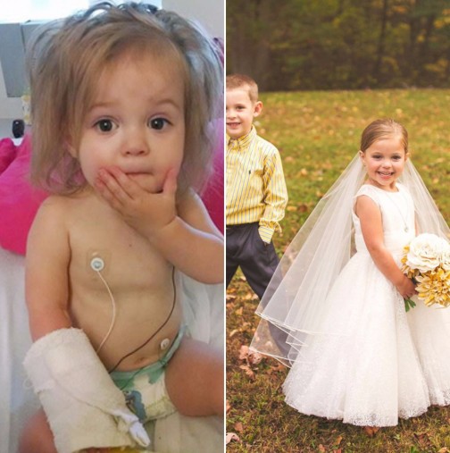Необичайна сватбена фотосесия на болно дете: Бях уплашена, че това ще е единственият път, когато ще видя детето си в булчинска рокля