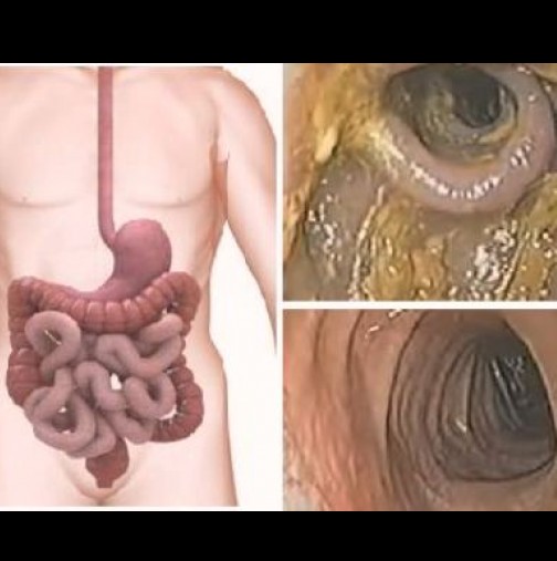 48-часов детокс, три органа участват в него-Едновременно пречистване на черния дроб, бъбреците, дебелото черво измита всичко отровно