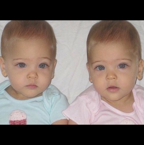 Те се родиха през 2010 година, а днес всеки като ги види как изглеждат, смята че това са най-красивите близначки на света