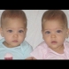 Те се родиха през 2010 година, а днес всеки като ги види как изглеждат, смята че това са най-красивите близначки на света