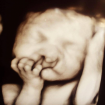 Лекарите направиха ултразвук и посъветваха майката да направи аборт-тя отказа и правилно-Ето как изглежда днес!