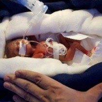 Ето новороденото, което оцеля, въпреки теглото си! 