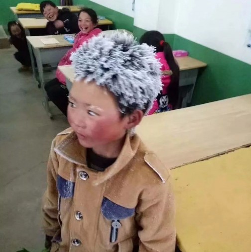 Детето със замръзналата коса: Историята на този ученик привлече вниманието на милиони хора в социалните мрежи