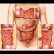Рязко спада границата на годините при заболяемост от рак на дебелото черво