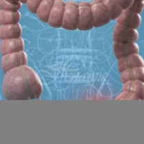 4 ранни симптоми на рак на дебелото черво са игнорирани от почти всички! Това ще помогне да се предотврати сериозно заболяване!