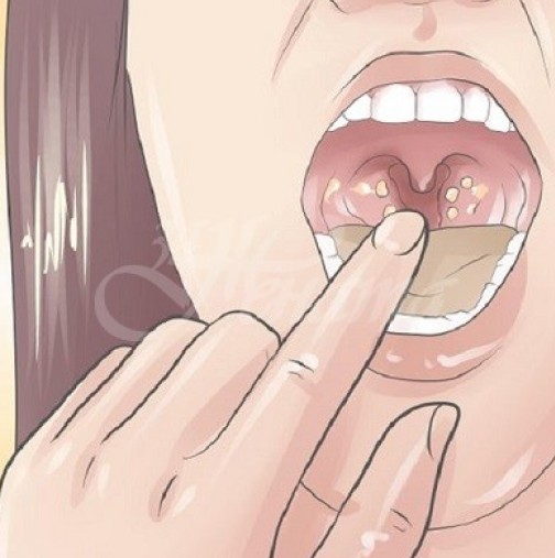 Това може да причини лош дъх! Ако дъвката не дава правилния ефект-Всеки, който е опитал, вече е забравил за проблеми в гърлото!