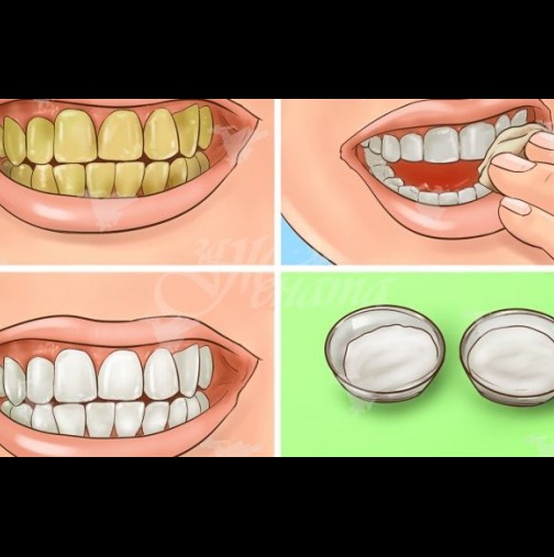 Избелване на зъби за по-малко от 2 минути усилия-Бели зъбки като гъбки! 
