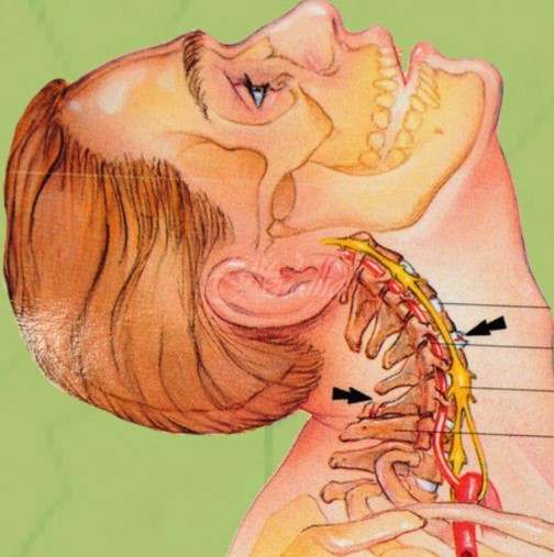 Много от жените не осъзнават, че проблемите със здравето са заради остеохондрозата-Ето как да се справите!