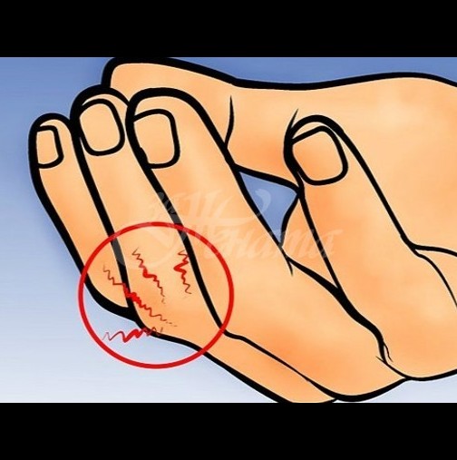 Специална точка на пръста-Облекчава болка и лекува-Ако се чувствате зле, натиснете върху точката и задръжте