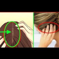 Признаци на инфаркт по косата