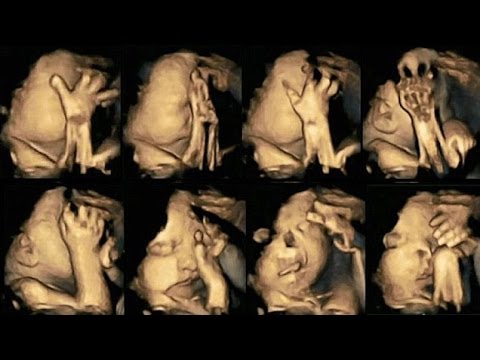 Видео: Ултразвук на бебета на майки пушачки и непушачки
