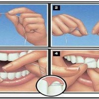 Как да си почистим правилно зъбите с конец?