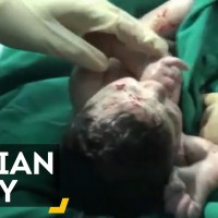 Лекари спасяват бебе