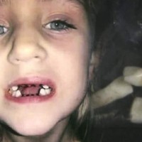 Зъболекар чудовище вади зъби на деца
