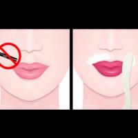 Как да се отървем от косъмчетата над устната