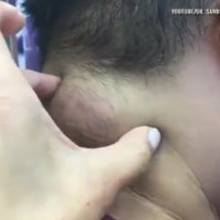 Човек операция на врат